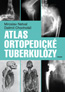 Book detailsAtlas ortopedické tuberkulózy