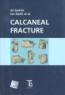 Detail knihyCalcaneal fracture