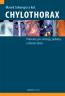 Detail knihyChylothorax. Průvodce pro chirurgy, pediatry a interní obory