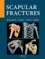 Detail knihyScapular fractures